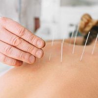 accupuncture-733x450